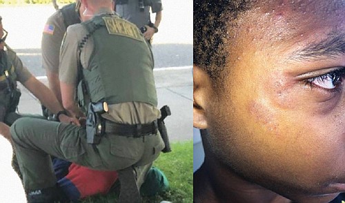 The mother of a young African American male filed a lawsuit, saying three sheriff’s deputies pinned him to the ground ... The mother of a young African American male filed a lawsuit, saying three sheriff’s deputies pinned him to the ground ...