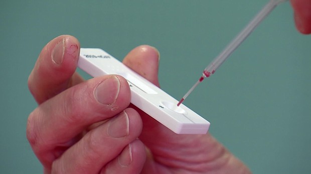 After people are infected with the novel coronavirus, their natural immunity to the virus could decline within months, a new pre-print paper suggests./Credit:	CDC