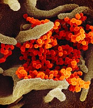 This scanning electron microscope image shows SARS-CoV-2 (orange)—also known as 2019-nCoV, the virus that causes COVID-19—isolated from a patient in the U.S., emerging from the surface of cells (green) cultured in the lab./Credit:	NIAID-RML