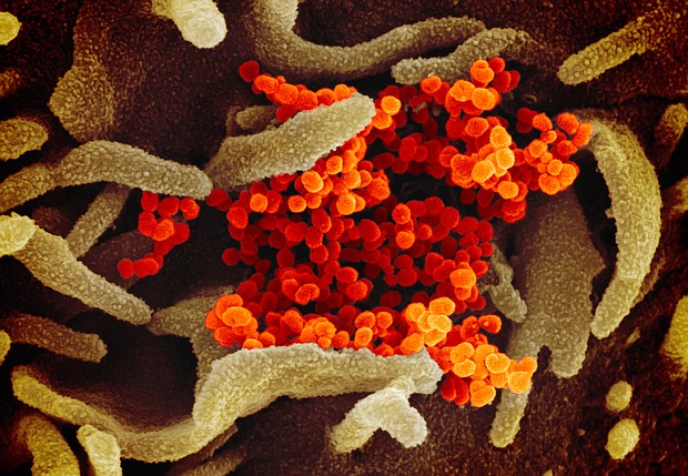 This scanning electron microscope image shows SARS-CoV-2 (orange)—also known as 2019-nCoV, the virus that causes COVID-19—isolated from a patient in the U.S., emerging from the surface of cells (green) cultured in the lab. Credit: NIAID-RML/Credit:	NIAID-RML