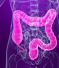 The US Preventive Services Task Force is considering a draft recommendation to lower the recommended screening age for colon and rectal cancers to 45.
Credit:	Getty Images