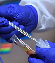 A blood sample is prepared for analysis by a laboratory technician at Accel Research Sites on August 4, 2020 in DeLand, Florida.
Credit: Paul Hennessy/NurPhoto/Getty Images/FILE