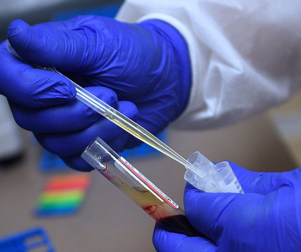 A blood sample is prepared for analysis by a laboratory technician at Accel Research Sites on August 4, 2020 in DeLand, Florida.
Credit:	Paul Hennessy/NurPhoto/Getty Images/FILE