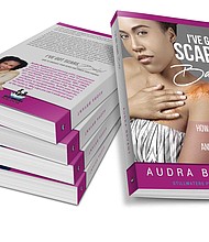 Audra Bryant has written a book entitled, I’ve Got Scars Baby! How to Embrace Your Scars and Power Your Purpose.