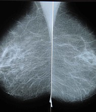 Tales of unnecessary biopsies spurred the patient care committee of the Society of Breast Imaging (SBI) to put out an advisory in January.
Credit:	Shutterstock