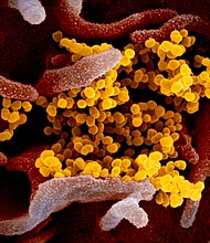 A rural Illinois bar opening event in February was linked to a Covid-19 outbreak of at least 46 cases, a school closure and the hospitalization of a long-term care facility resident, according to a United States Centers for Disease Control and Prevention report.
Mandatory Credit:	NIAID-RML