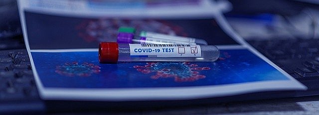 MDH launches free statewide mobile COVID-19 testing program - Vimarsana News