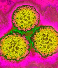 The first generation Human papillomavirus (HPV) vaccine cut cervical cancer rates among women by 87%, British researchers reported.
Mandatory Credit: BSIP/Universal Images Group/Getty Images