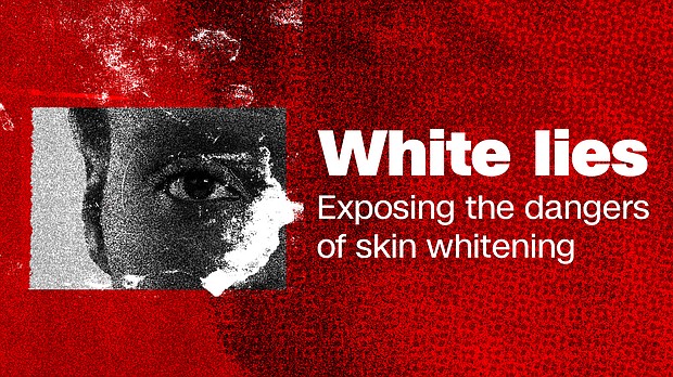 CNN investigates skin whitening practices worldwide to expose the underlying drivers of colorism.
Mandatory Credit:	CNN/Getty