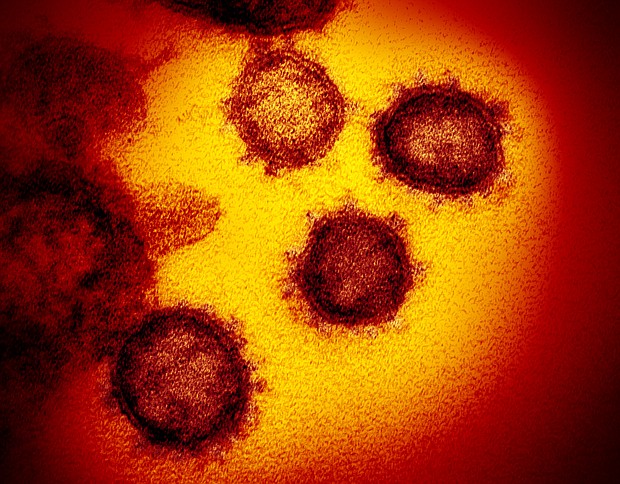 After a weekend of muted celebrations, Americans face the uncertainty of a new year as the nation battles another coronavirus wave, this time driven by the highly contagious Omicron variant.
	NIAID-RML
