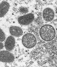 The United States is responding to a request for the release of monkeypox vaccine from the nation's Strategic National Stockpile as a global outbreak of cases is under investigation.
Mandatory Credit: Cynthia S. Goldsmith, Russell Regner/CDC via AP