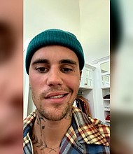 Justin Bieber has shared a faith-filled update about a rare medical condition that has resulted in one side of his face being paralyzed.
Mandatory Credit:	@JustinBieber