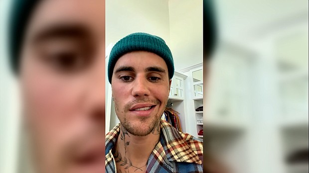 Justin Bieber has shared a faith-filled update about a rare medical condition that has resulted in one side of his face being paralyzed.
Mandatory Credit:	@JustinBieber