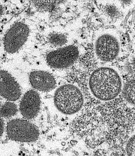 As monkeypox cases continue to rise globally, the World Health Organization plans to reassess whether the outbreak constitutes a public health emergency of international concern.
Mandatory Credit:	Cynthia S. Goldsmith, Russell Regner/CDC/AP