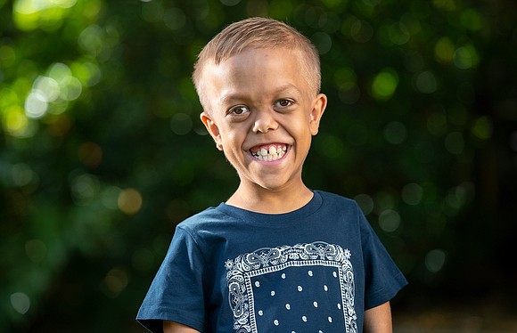 Quaden Bayles, an indigenous Australian boy who won the support of celebrities and well-wishers around the globe after being bullied …