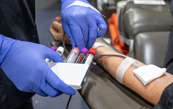 The US Food and Drug Administration is proposing a blood donation policy that focuses on individual risk instead of blanket …