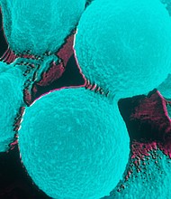 Most people exposed to cryptococcus neoformans won't get sick, but some do.
Mandatory Credit:	BSIP/Universal Images/Getty Images
Dateline:	File