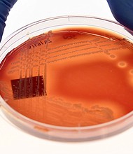 Climate change is contributing to the rise of superbugs, according to a United Nations report. Displayed is the superbug Staphylcocus epidermidis on an agar plate in Melbourne on September 4, 2018.
Mandatory Credit:	William West/AFP/Getty Images