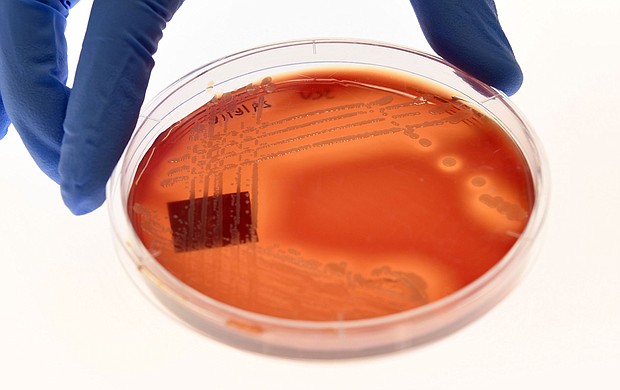 Climate change is contributing to the rise of superbugs, according to a United Nations report. Displayed is the superbug Staphylcocus epidermidis on an agar plate in Melbourne on September 4, 2018.
Mandatory Credit:	William West/AFP/Getty Images
