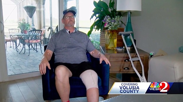 Daytona Beach police officers responded to a home Saturday night after being notified about an alligator attack. According to police, officers were called to a home on Champions Drive around 9:42 p.m. Saturday after a resident was bitten by a gator.
Mandatory Credit:	WESH