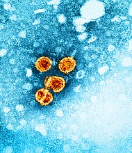 The US Centers for Disease Control and Prevention says all adults should be screened for hepatitis B.
Mandatory Credit:	NIAID/CDC
