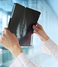 The American Cancer Society currently recommends that all women consider mammogram screenings for breast cancer risk starting at the age of 40.
Mandatory Credit:	Shutterstock