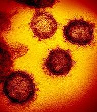 This transmission electron microscope image shows SARS-CoV-2—also known as 2019-nCoV, the virus that causes COVID-19. isolated from a patient in the U.S., emerging from the surface of cells cultured in the lab.
Mandatory Credit:	NIAID-RML