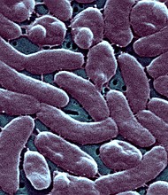 Vibrio vulnificus lives in warm, salty or brackish water and comes from the same family as the bacteria that causes cholera.
Mandatory Credit:	BSIP/Universal Images Group/Getty Images