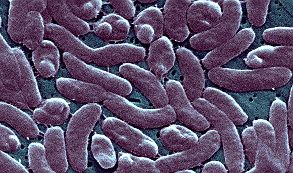 At least three people have died in Connecticut and New York after contracting a rare flesh-eating bacteria that can be …