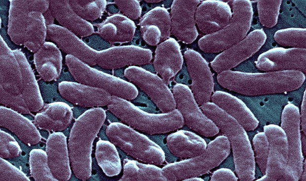 Vibrio vulnificus lives in warm, salty or brackish water and comes from the same family as the bacteria that causes cholera.
Mandatory Credit:	BSIP/Universal Images Group/Getty Images