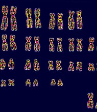Humans have 23 pairs of chromosomes. At bottom right are the pair of sex chromosomes XY or XX that determines sex.
Mandatory Credit:	BSIP/Universal Images Group/Getty Images