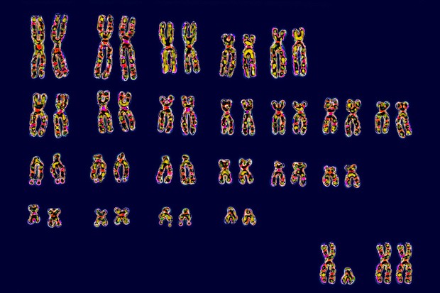 Humans have 23 pairs of chromosomes. At bottom right are the pair of sex chromosomes XY or XX that determines sex.
Mandatory Credit:	BSIP/Universal Images Group/Getty Images