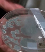 A woman says mold is forcing her out of her Overland Park, Kansas apartment.
Mandatory Credit:	KCTV via CNN Newsource