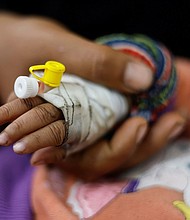 A Palestinian child suffering from malnutrition receives treatment at a healthcare center in Rafah, in southern Gaza, on March 4. Children and mothers are among those most at risk of severe malnutrition.
Mandatory Credit:	Mohammed Salem/Reuters via CNN Newsource