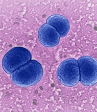 US health are urging doctors to watch for certain types of rare, serious infections caused by the bacteria Neisseria meningitidis.
Mandatory Credit:	BSIP/Universal Images Group/Getty Images via CNN Newsource