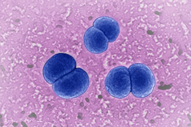 US health are urging doctors to watch for certain types of rare, serious infections caused by the bacteria Neisseria meningitidis.
Mandatory Credit:	BSIP/Universal Images Group/Getty Images via CNN Newsource