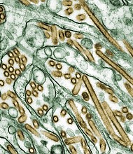 Bird flu poses a threat to some farm workers.
Mandatory Credit:	Smith Collection/Gado/Getty Images via CNN Newsource