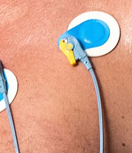 Few treatments are available for a type of heart failure that includes mildly reduced or preserved ejection fraction.
Mandatory Credit:	simonkr/E+/Getty Images/File via CNN Newsource