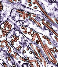 Decades of research have showed scientists what mutations to watch for in the H5N1 virus.
Mandatory Credit:	Callista Images/Image Source/Getty Images via CNN Newsource