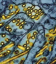 The California Department of Public Health is reporting a child is recovering after possible case of bird flu.
Mandatory Credit:	CDC/NIAID/AP via CNN Newsource