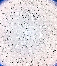 Sperm from the donor was used to conceive at least 67 children from 46 families.
Mandatory Credit:	Salah Uddin/iStockphoto/Getty Images via CNN Newsource