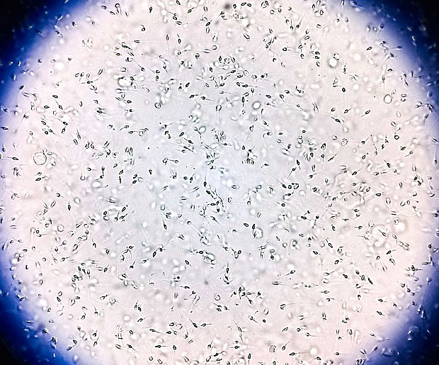 Sperm from the donor was used to conceive at least 67 children from 46 families.
Mandatory Credit:	Salah Uddin/iStockphoto/Getty Images via CNN Newsource