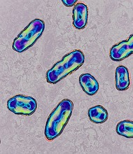 Plague is caused by the bacteria Yersinia pestis and is spread to humans through infected flea bites or contact with infected animals.
Mandatory Credit:	BSIP/Universal Images Group Editorial/Getty Images/File via CNN Newsource