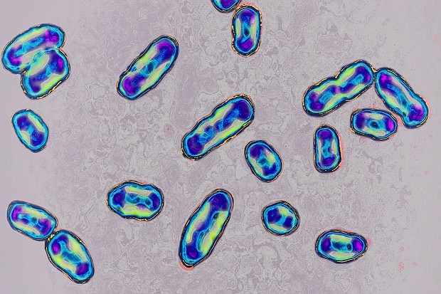 Plague is caused by the bacteria Yersinia pestis and is spread to humans through infected flea bites or contact with infected animals.
Mandatory Credit:	BSIP/Universal Images Group Editorial/Getty Images/File via CNN Newsource