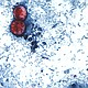 Cyclosporiasis outbreak