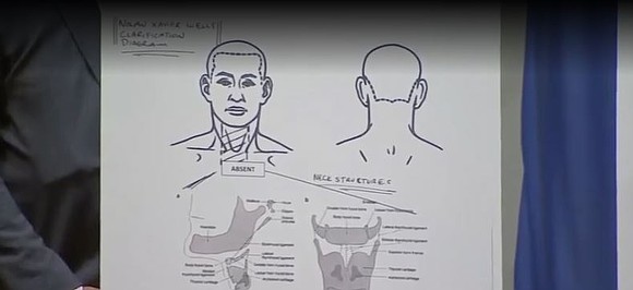 A second autopsy has left the cause of 18-year-old Nolan Wells' death undetermined, as new findings and unanswered questions fuel … A second autopsy has left the cause of 18-year-old Nolan Wells' death undetermined, as new findings and unanswered questions fuel …