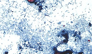 Cyclospora