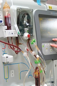 Lead photo